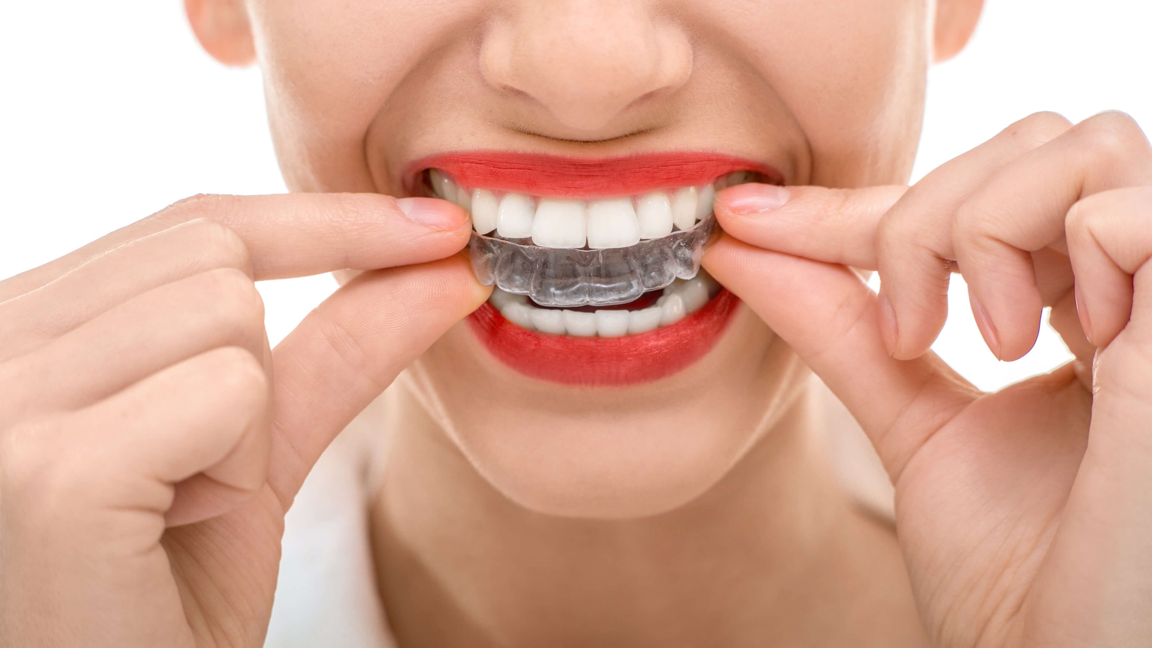 woman holding invisalign